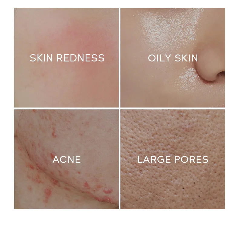 Sérum facial de chá verde Laikou, controle de oleosidade, antienvelhecimento, redução de poros, tratamento para acne, clareamento, hidratação, essência de melaleuca, cuidados com a pele
