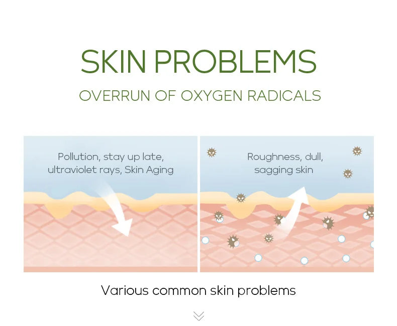 Sérum facial de chá verde Laikou, controle de oleosidade, antienvelhecimento, redução de poros, tratamento para acne, clareamento, hidratação, essência de melaleuca, cuidados com a pele