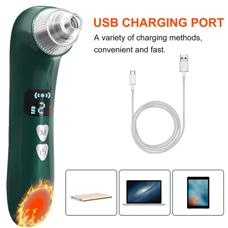 AOKO Removedor de Cravos, Câmera de Vácuo para Poros, Limpador de Poros, Removedor de Acne, Aquecimento Elétrico, Limpeza Profunda do Nariz e Rosto, Microscópio Wi-Fi