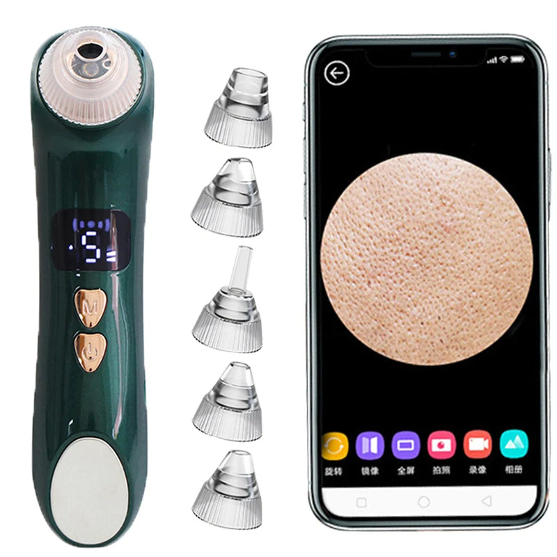AOKO Removedor de Cravos, Câmera de Vácuo para Poros, Limpador de Poros, Removedor de Acne, Aquecimento Elétrico, Limpeza Profunda do Nariz e Rosto, Microscópio Wi-Fi