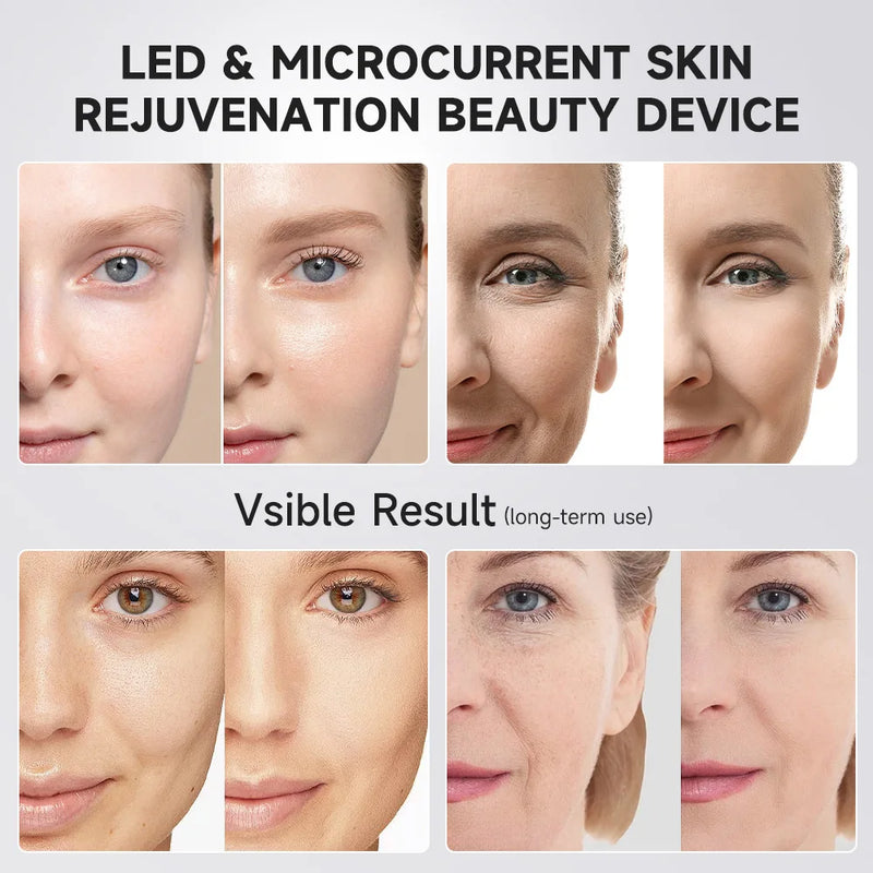 Booster Pro LED Facial Light Therapy 5 Cores Varinha de Beleza para os Olhos Massageador de Olhos com Luz Vermelha para Ferramenta de Rejuvenescimento da Pele