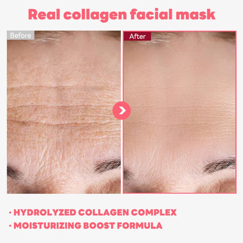 Máscara facial coreana de colágeno, máscara facial antirrugas de colágeno, máscara de lifting facial hidratante e tensora