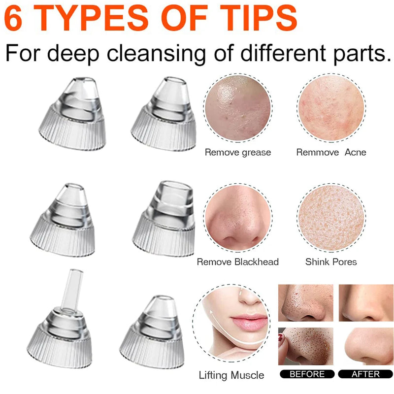AOKO Removedor de Cravos, Câmera de Vácuo para Poros, Limpador de Poros, Removedor de Acne, Aquecimento Elétrico, Limpeza Profunda do Nariz e Rosto, Microscópio Wi-Fi