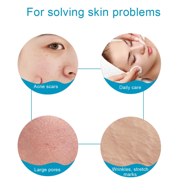 ZGTS DRS 540 Pins Derma Roller Titânio Aço Inoxidável Rolo de Enfermagem para Pele Esfoliante Antirrugas Reparador para Recrescimento Capilar Ferramenta de Maquiagem