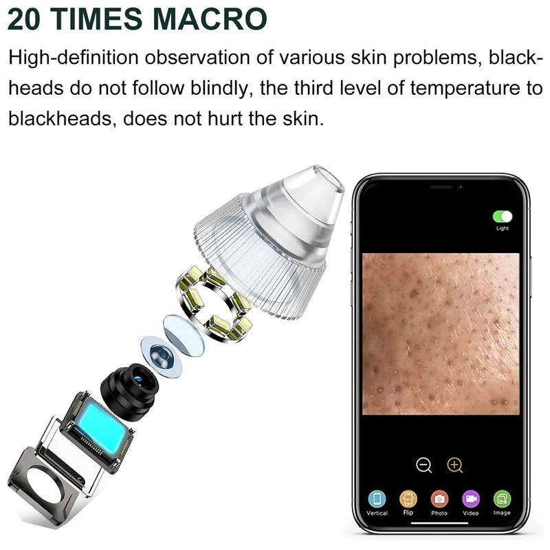 AOKO Removedor de Cravos, Câmera de Vácuo para Poros, Limpador de Poros, Removedor de Acne, Aquecimento Elétrico, Limpeza Profunda do Nariz e Rosto, Microscópio Wi-Fi