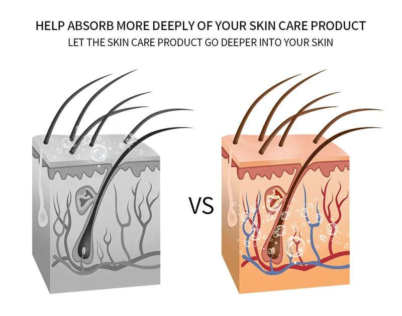 5 em 1 RF Radiofrequência EMS Eletroporação LED Fóton Dispositivo de Beleza Lifting de Pele Firme Anti-Rugas Cuidados com a Pele Massageador Facial
