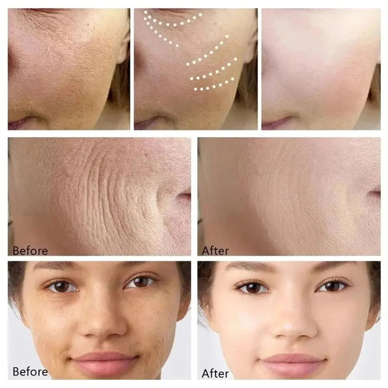 Máscara facial de biocolágeno 1/3/5/10 unidades, antirrugas, suaviza linhas finas, lifting, pele firme, antienvelhecimento, clareia a pele, cosméticos coreanos